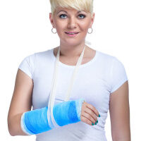 Female patient with broken arm in cast on a white background